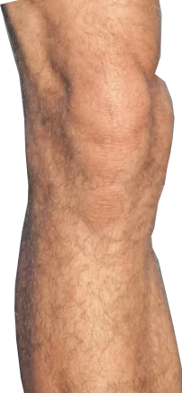 Joelho
